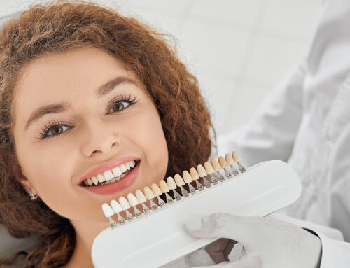 Faccette dentali : il sistema innovativo che corregge i difetti dei denti