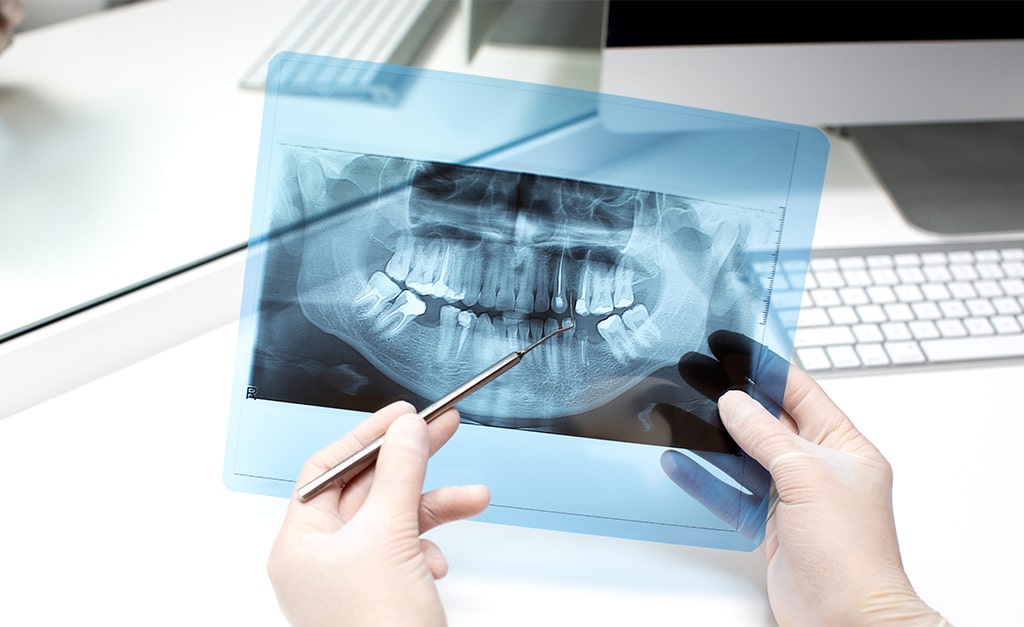 radiografie dentali